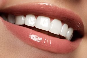mill valley Cosmetic Dentistry